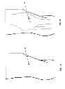 Fig. 02 - Methods and devices for preventing tissue bridging while suturing