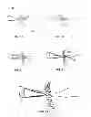 Fig. 06 - Methods and devices for preventing tissue bridging while suturing