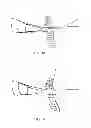 Fig. 09 - Methods and devices for preventing tissue bridging while suturing