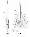 Fig. 06 - Suturing device with split arm and method of suturing tissue