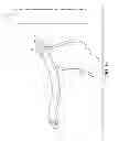 Fig. 07 - Surgical instrument for manipulating and passing suture