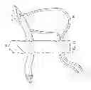 Fig. 13 - Surgical instrument for manipulating and passing suture