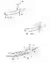 Fig. 24 - Surgical instrument for manipulating and passing suture