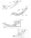 Fig. 31 - Surgical instrument for manipulating and passing suture