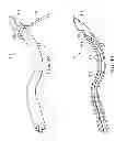 Fig. 34 - Surgical instrument for manipulating and passing suture