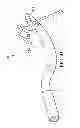 Fig. 35 - Surgical instrument for manipulating and passing suture