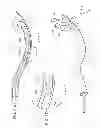 Fig. 43 - Surgical instrument for manipulating and passing suture