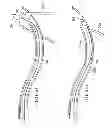 Fig. 53 - Surgical instrument for manipulating and passing suture