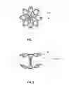 Fig. 02 - Method and Device for Connecting a Conduit to a Hollow Organ