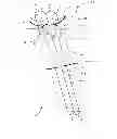 Fig. 01 - Transcend surgical clips for laproscopic procedures