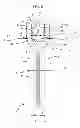 Fig. 07 - Transcend surgical clips for laproscopic procedures