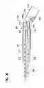 Fig. 33 - Tissue-removing catheter including force-transmitting member for actuating a cutter housing