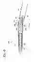 Fig. 46 - Tissue-removing catheter including force-transmitting member for actuating a cutter housing