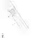 Fig. 09 - Tissue-removing catheter with ball and socket deployment mechanism