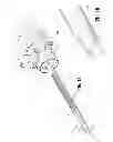 Fig. 02 - Access sheath with blade