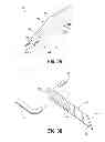 Fig. 06 - Access sheath with blade