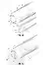 Fig. 08 - Access sheath with blade