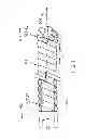 Fig. 02 - Method, system, and fastener for anchoring a corpus