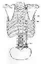 Fig. 01 - Bone support apparatus
