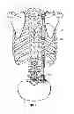 Fig. 02 - Bone support apparatus
