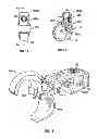 Fig. 07 - Bone support apparatus