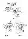 Fig. 08 - Bone support apparatus