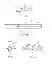 Fig. 08 - Maintenance feature in magnetic implant