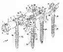 Fig. 01 - Soft stabilization assemblies with off-set connector