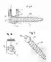 Fig. 07 - BONE ANCHORING DEVICE