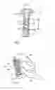 Fig. 02 - Stabilization device for bones comprising a spring element and manufacturing method for said spring element