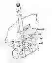 Fig. 01 - Methods and devices for spinal fixation element placement