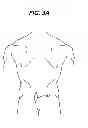Fig. 04 - Methods and devices for spinal fixation element placement