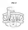 Fig. 06 - Methods and devices for spinal fixation element placement