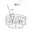 Fig. 07 - Methods and devices for spinal fixation element placement
