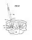 Fig. 08 - Methods and devices for spinal fixation element placement