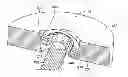 Fig. 01 - Variable angled locking screw
