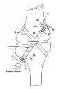 Fig. 01 - Orthopedic implant having non-circular cross section and method of use thereof
