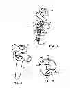 Fig. 10 - Polyaxial screw