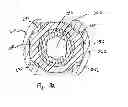 Fig. 19 - Polyaxial screw