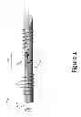Fig. 02 - PROXIMAL INTERPHALANGEAL FUSION DEVICE