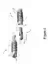 Fig. 05 - PROXIMAL INTERPHALANGEAL FUSION DEVICE