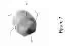 Fig. 08 - PROXIMAL INTERPHALANGEAL FUSION DEVICE