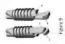 Fig. 10 - PROXIMAL INTERPHALANGEAL FUSION DEVICE