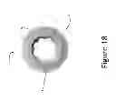 Fig. 19 - PROXIMAL INTERPHALANGEAL FUSION DEVICE