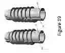 Fig. 20 - PROXIMAL INTERPHALANGEAL FUSION DEVICE