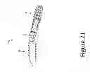 Fig. 22 - PROXIMAL INTERPHALANGEAL FUSION DEVICE