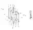 Fig. 23 - PROXIMAL INTERPHALANGEAL FUSION DEVICE