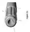 Fig. 33 - PROXIMAL INTERPHALANGEAL FUSION DEVICE