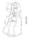 Fig. 36 - PROXIMAL INTERPHALANGEAL FUSION DEVICE