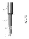 Fig. 37 - PROXIMAL INTERPHALANGEAL FUSION DEVICE
